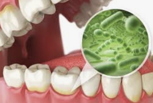 Does The Prodentim Supplement Really Work For Dental Care